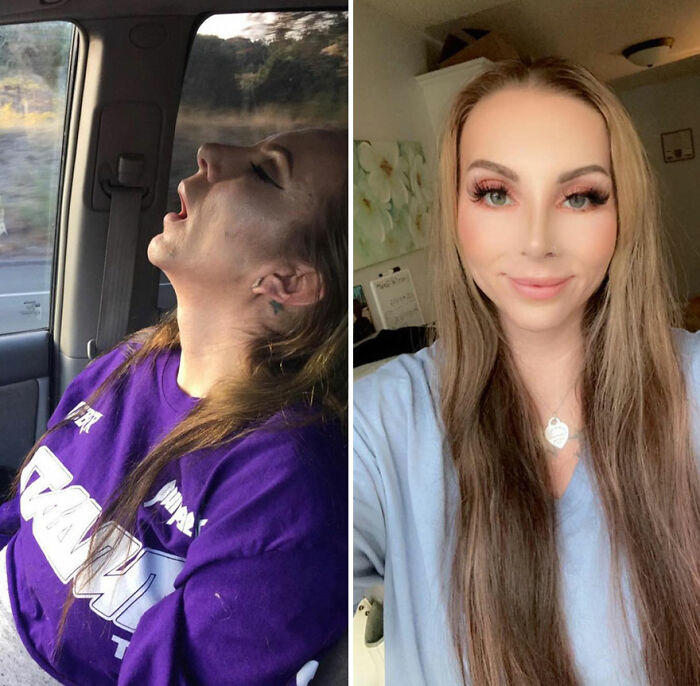 50 Before-And-After Pics And Inspiring Stories About Life-Changing Recoveries