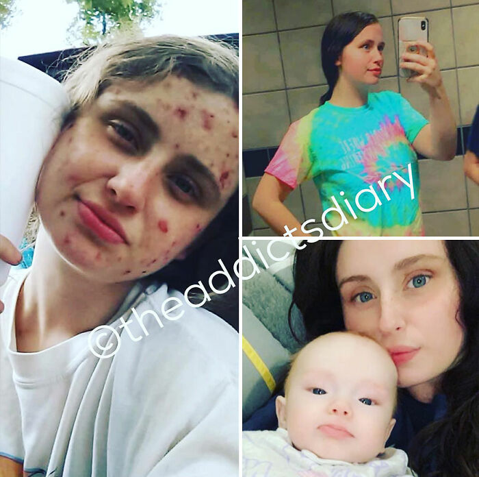 50 Before-And-After Pics And Inspiring Stories About Life-Changing Recoveries