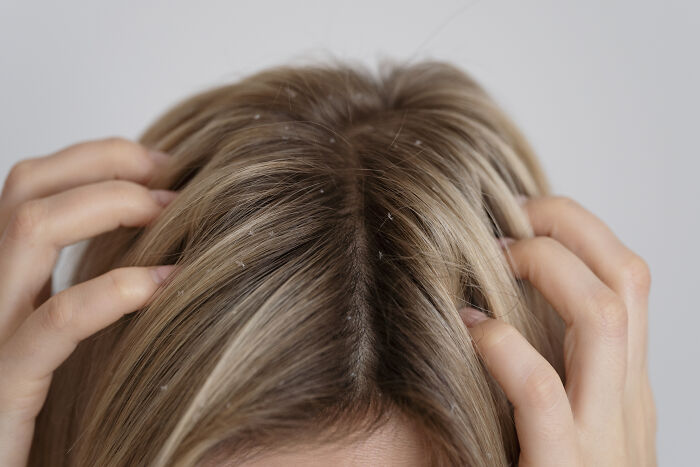 35 People Recall The Grossest, Most Unexpected Things They’ve Ever Witnessed In Strangers’ Homes