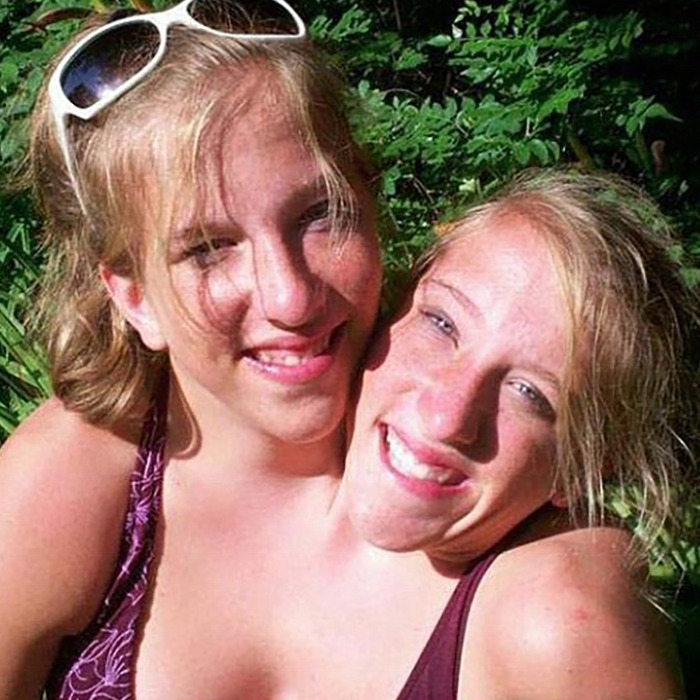 &#8220;They Look Like They Need Sleep&#8221;: Abby &#038; Brittany Hensel’s Baby Sets Off Heated Discussion