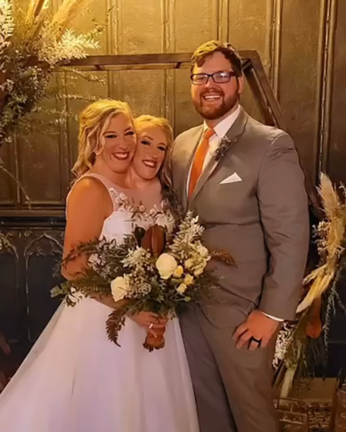&#8220;They Look Like They Need Sleep&#8221;: Abby &#038; Brittany Hensel’s Baby Sets Off Heated Discussion