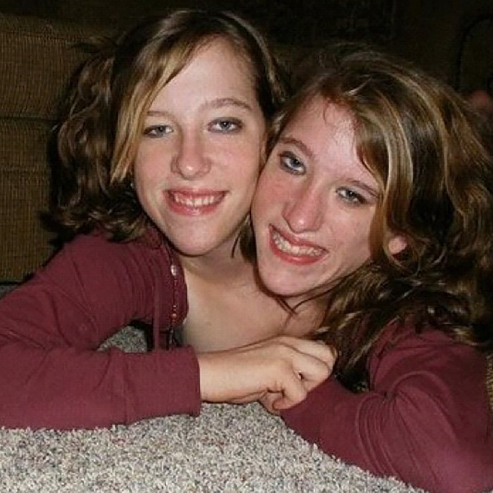 &#8220;They Look Like They Need Sleep&#8221;: Abby &#038; Brittany Hensel’s Baby Sets Off Heated Discussion