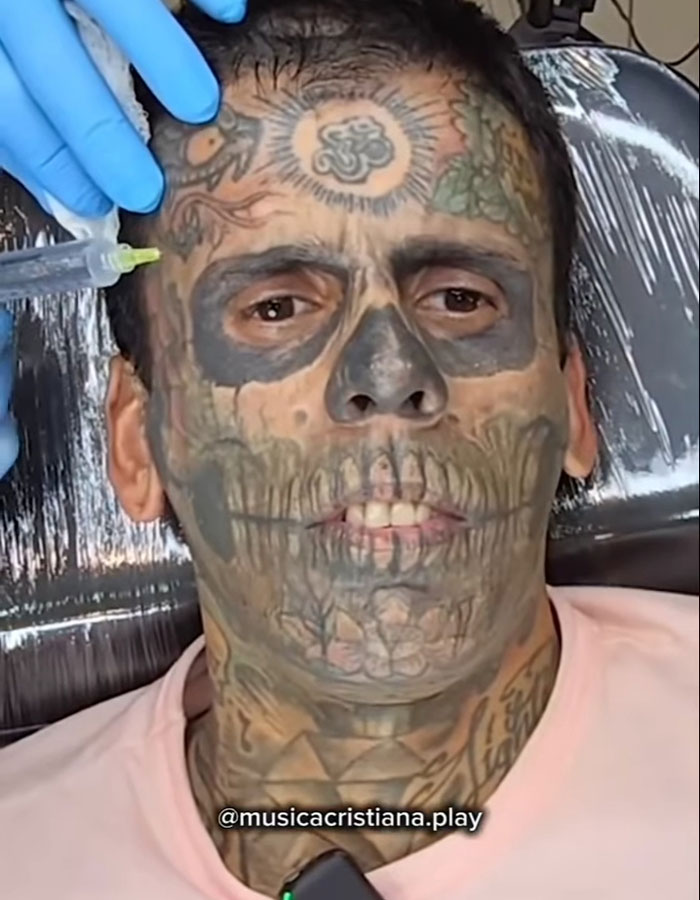 &#8220;Looked Better With Them&#8221;: 95% Tattooed Man Reveals Shocking Look After Laser Removal