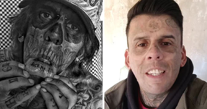 &#8220;Looked Better With Them&#8221;: 95% Tattooed Man Reveals Shocking Look After Laser Removal