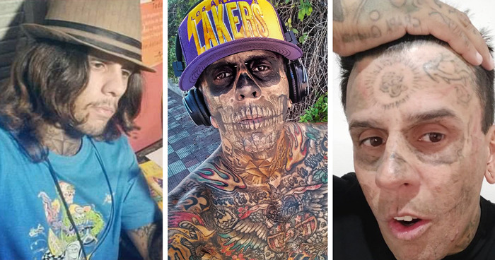 &#8220;Looked Better With Them&#8221;: 95% Tattooed Man Reveals Shocking Look After Laser Removal