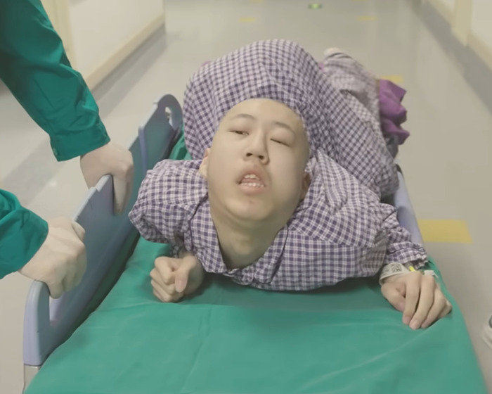 &#8216;Folded Boy&#8217; Who Was Bent At 180 Degrees For Most Of His Life Stuns With &#8216;Magical&#8217; Transformation