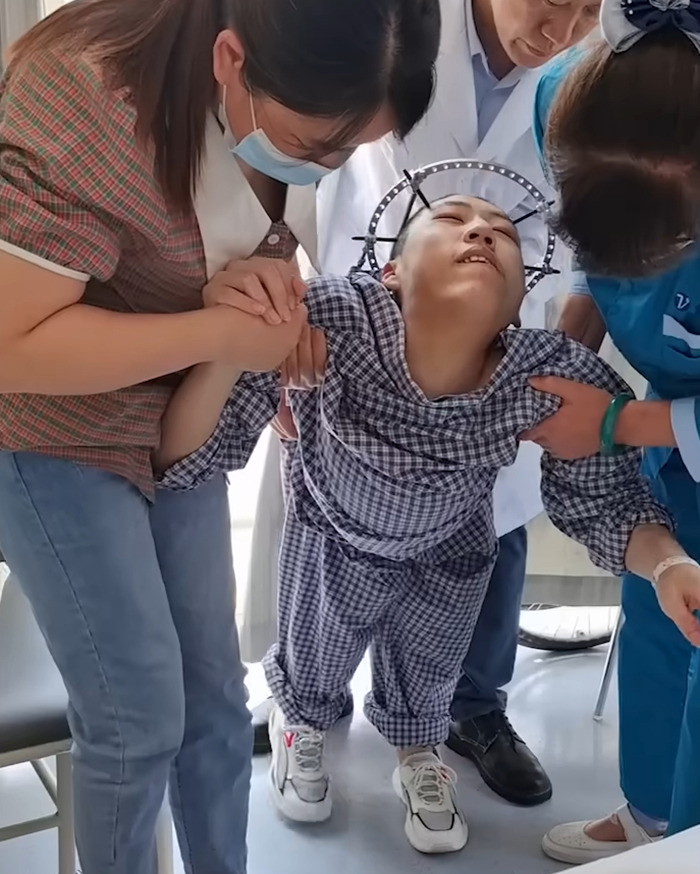 &#8216;Folded Boy&#8217; Who Was Bent At 180 Degrees For Most Of His Life Stuns With &#8216;Magical&#8217; Transformation