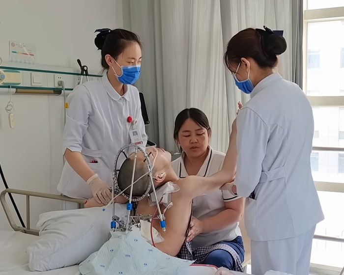 &#8216;Folded Boy&#8217; Who Was Bent At 180 Degrees For Most Of His Life Stuns With &#8216;Magical&#8217; Transformation