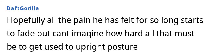 &#8216;Folded Boy&#8217; Who Was Bent At 180 Degrees For Most Of His Life Stuns With &#8216;Magical&#8217; Transformation