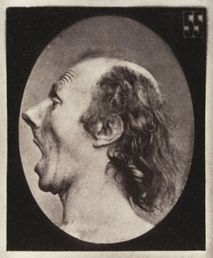 45 Pics From This Facial Expressions Experiment In The 19th Century Might Give You Nightmares