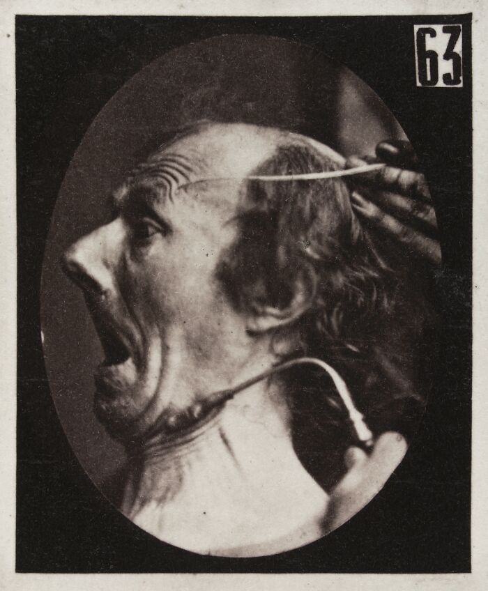 45 Pics From This Facial Expressions Experiment In The 19th Century Might Give You Nightmares