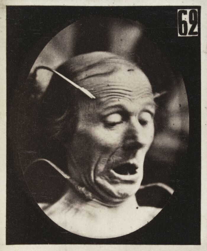 45 Pics From This Facial Expressions Experiment In The 19th Century Might Give You Nightmares
