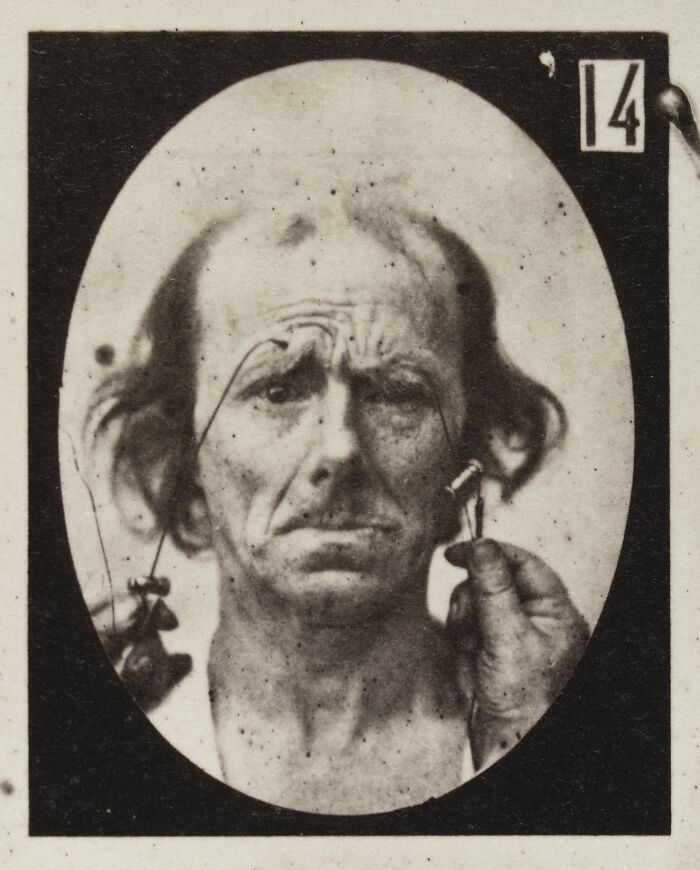 45 Pics From This Facial Expressions Experiment In The 19th Century Might Give You Nightmares