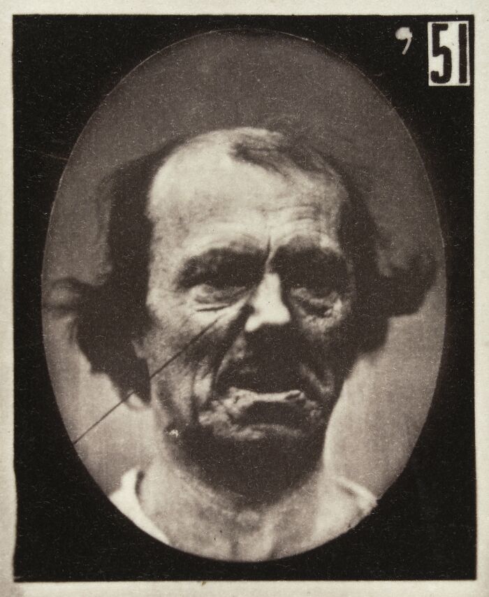 45 Pics From This Facial Expressions Experiment In The 19th Century Might Give You Nightmares