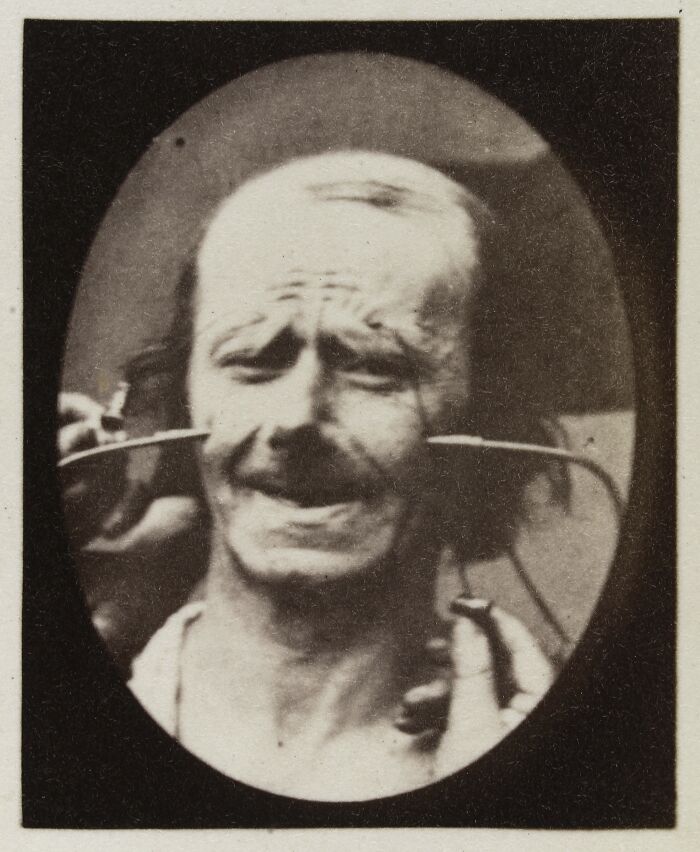 45 Pics From This Facial Expressions Experiment In The 19th Century Might Give You Nightmares