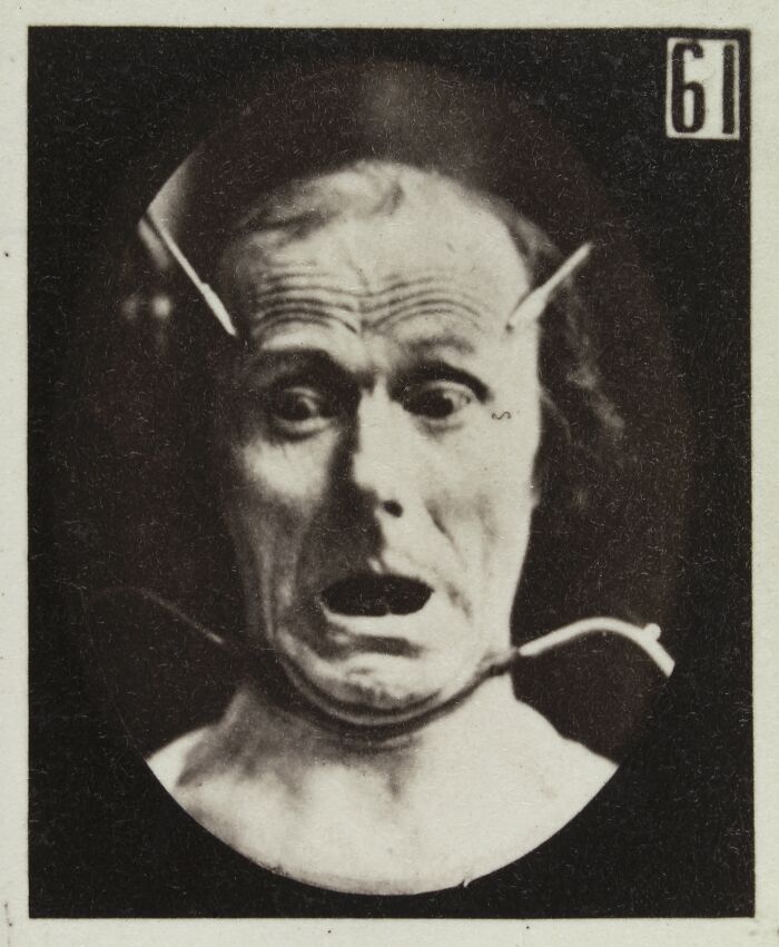 45 Pics From This Facial Expressions Experiment In The 19th Century Might Give You Nightmares