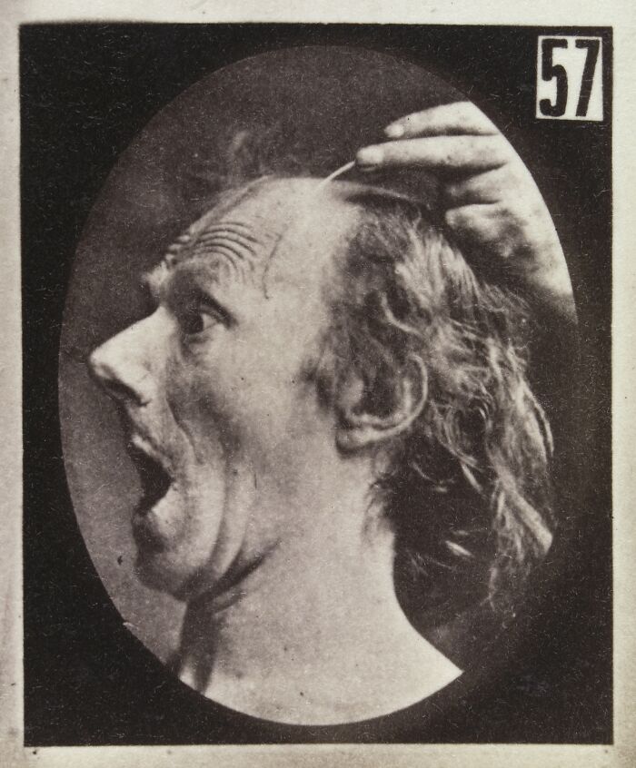 45 Pics From This Facial Expressions Experiment In The 19th Century Might Give You Nightmares