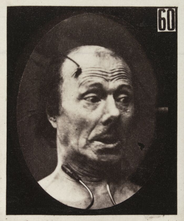 45 Pics From This Facial Expressions Experiment In The 19th Century Might Give You Nightmares