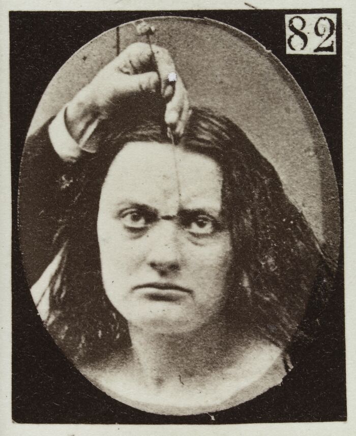 45 Pics From This Facial Expressions Experiment In The 19th Century Might Give You Nightmares