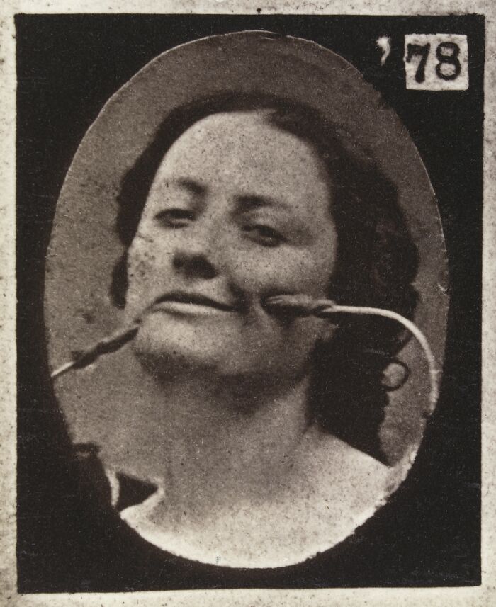45 Pics From This Facial Expressions Experiment In The 19th Century Might Give You Nightmares