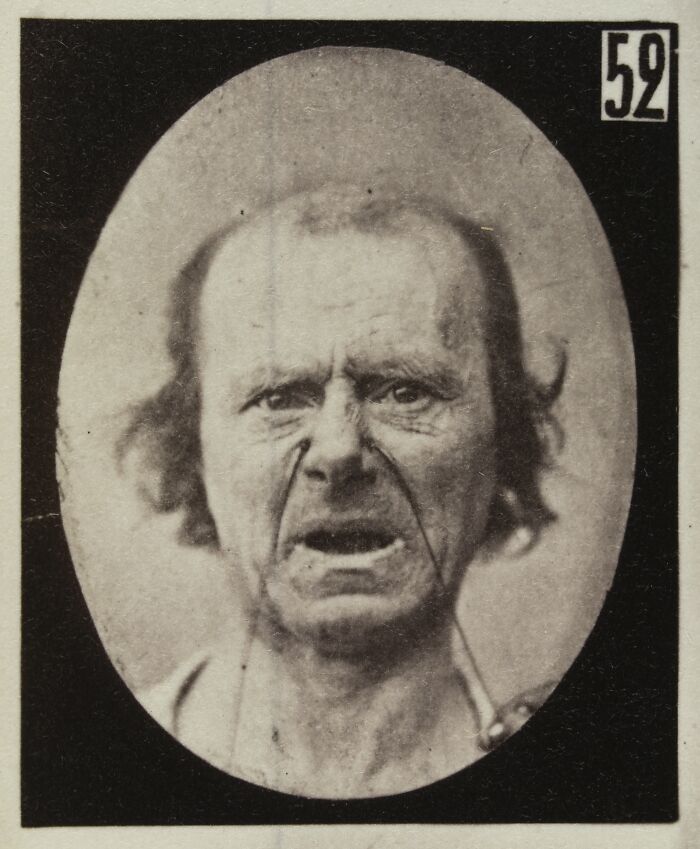 45 Pics From This Facial Expressions Experiment In The 19th Century Might Give You Nightmares