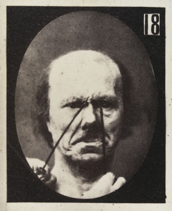 45 Pics From This Facial Expressions Experiment In The 19th Century Might Give You Nightmares