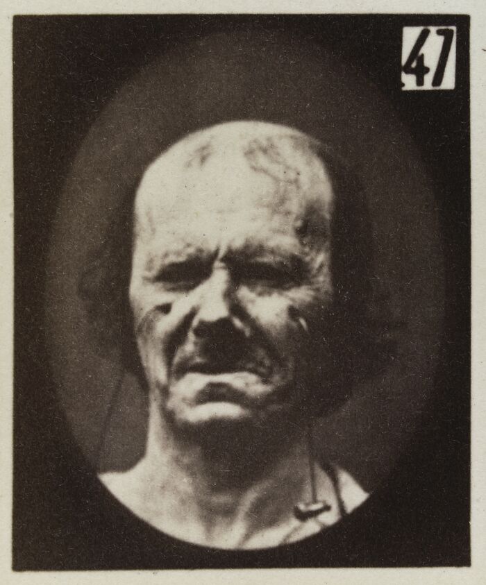 45 Pics From This Facial Expressions Experiment In The 19th Century Might Give You Nightmares