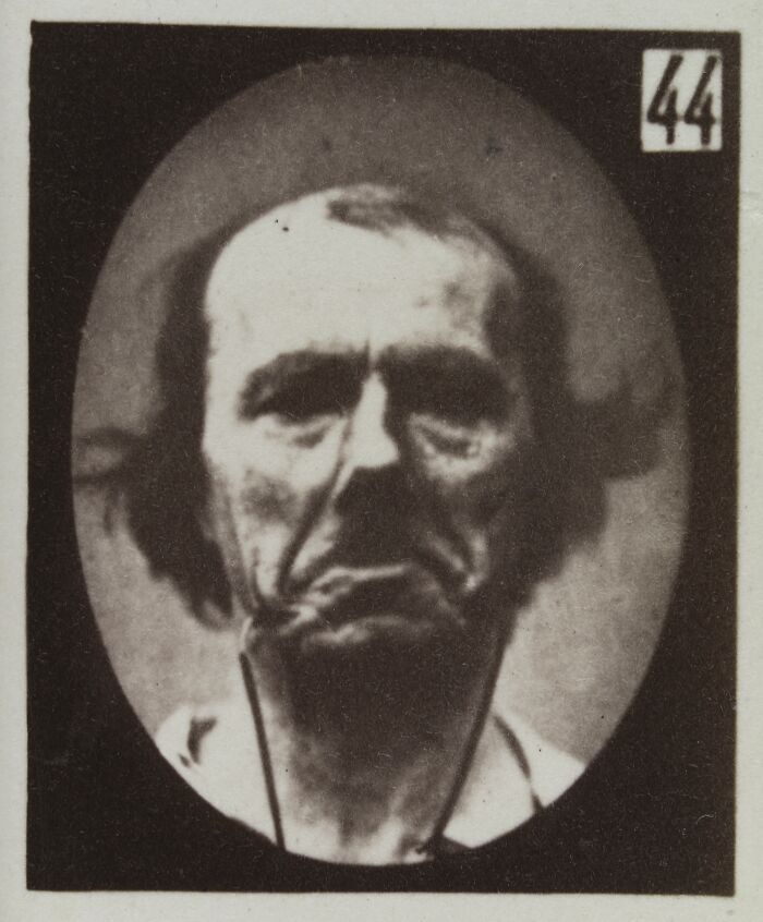 45 Pics From This Facial Expressions Experiment In The 19th Century Might Give You Nightmares