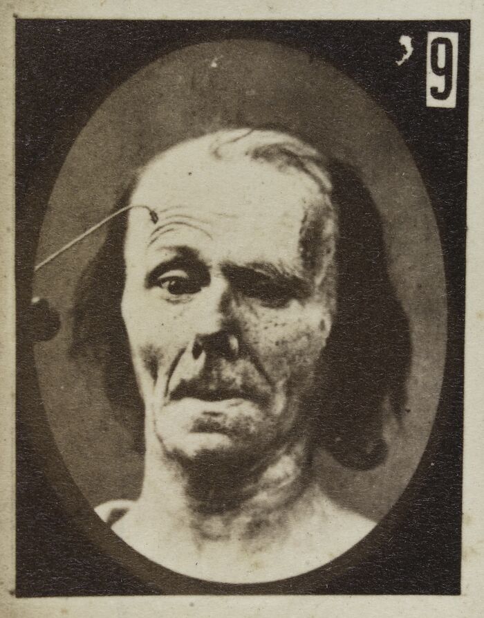 45 Pics From This Facial Expressions Experiment In The 19th Century Might Give You Nightmares