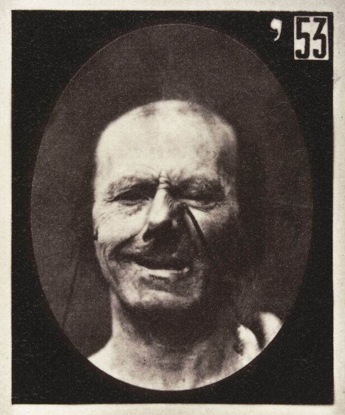 45 Pics From This Facial Expressions Experiment In The 19th Century Might Give You Nightmares