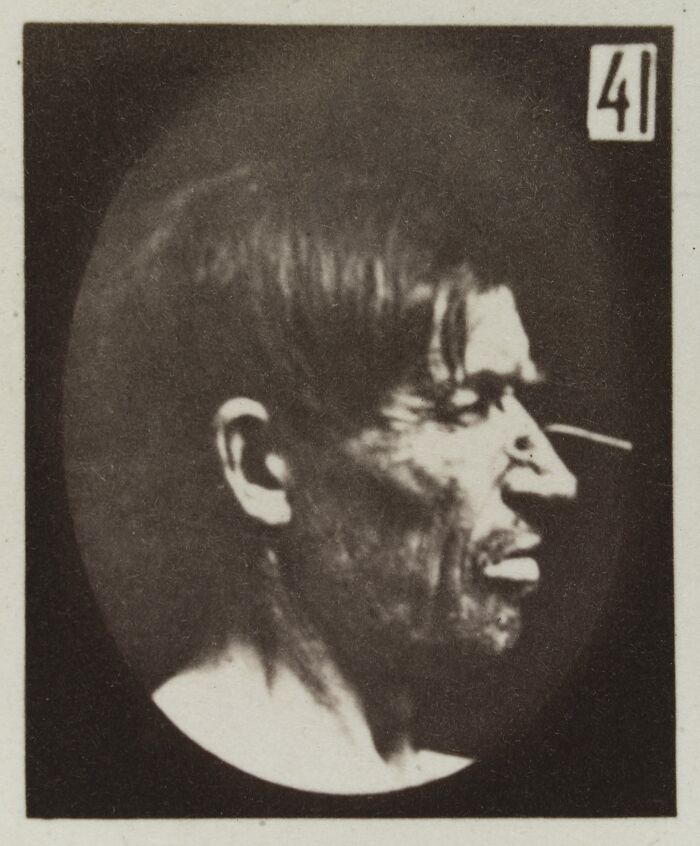 45 Pics From This Facial Expressions Experiment In The 19th Century Might Give You Nightmares