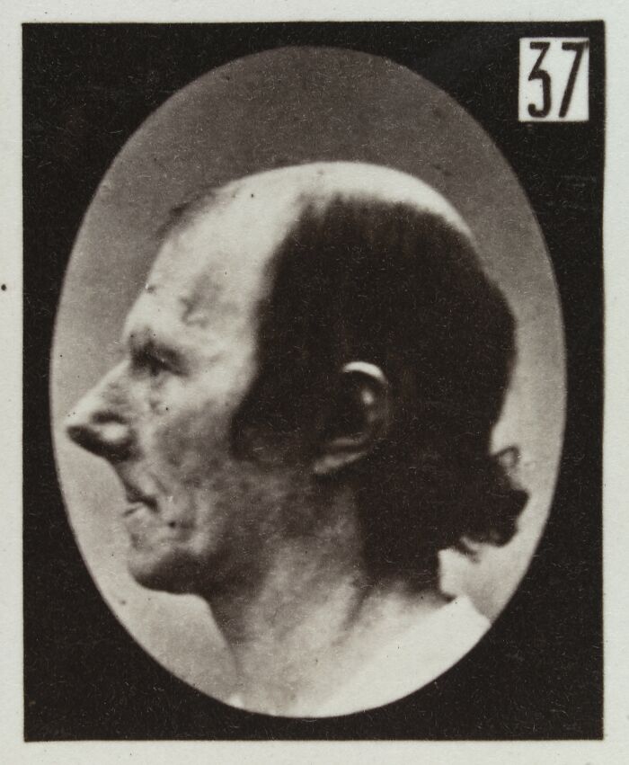 45 Pics From This Facial Expressions Experiment In The 19th Century Might Give You Nightmares