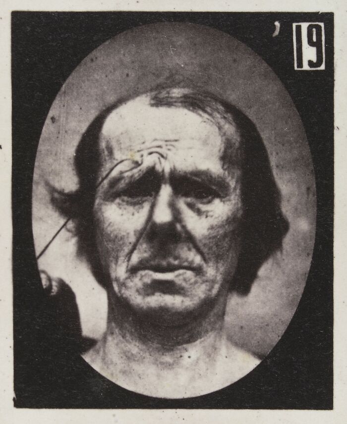 45 Pics From This Facial Expressions Experiment In The 19th Century Might Give You Nightmares