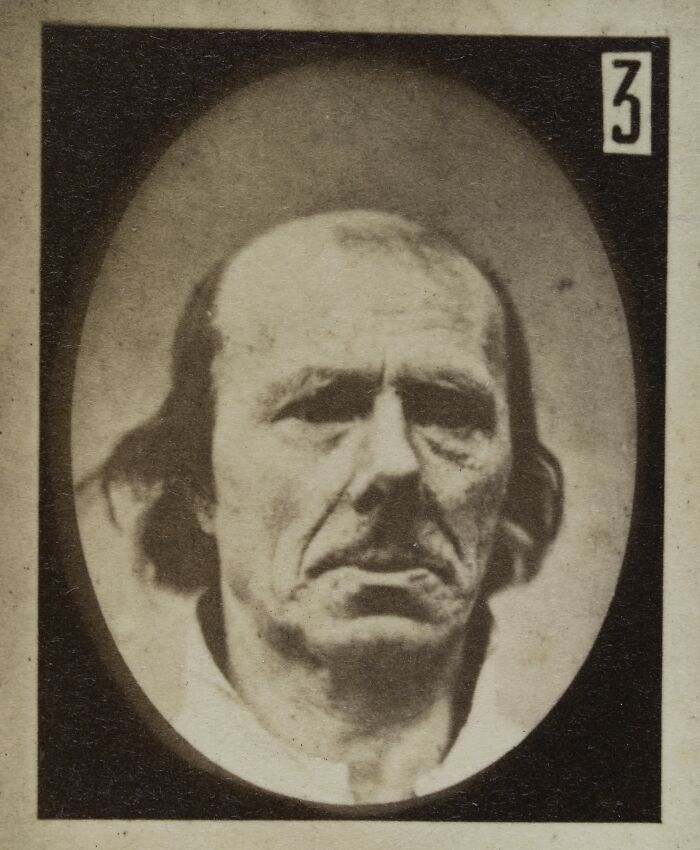 45 Pics From This Facial Expressions Experiment In The 19th Century Might Give You Nightmares