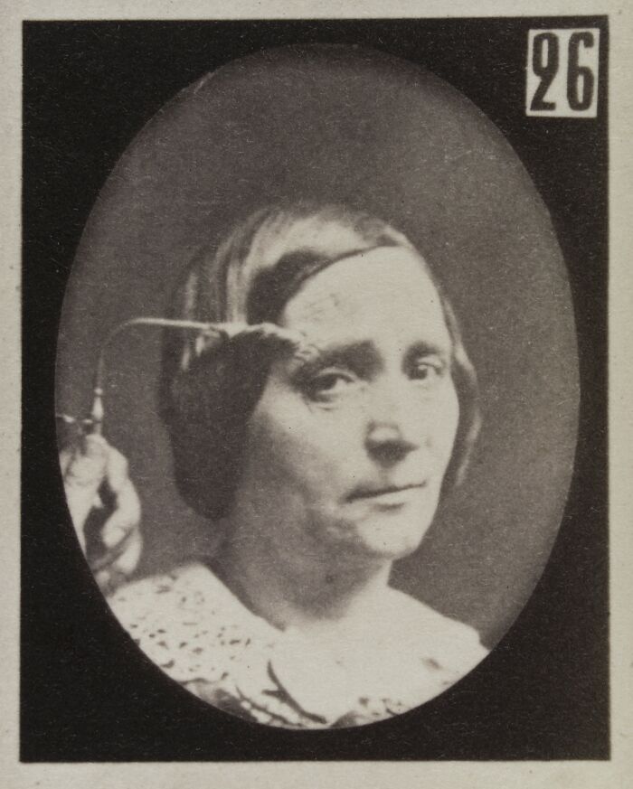 45 Pics From This Facial Expressions Experiment In The 19th Century Might Give You Nightmares
