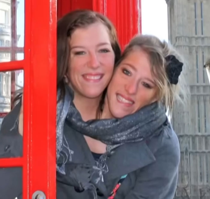 Conjoined Twins Abby And Brittany Finally Break Silence After Photos With Newborn Baby Go Viral