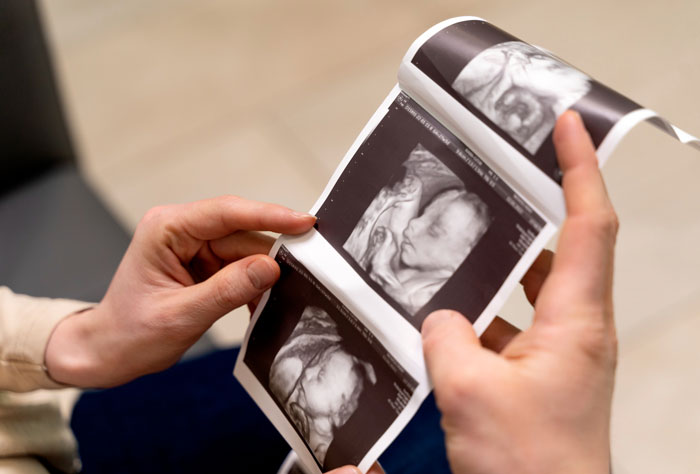 Woman Can&#8217;t Believe Sis Would Get Pregnant Despite Knowing The Hell She Faced Due To Genetic Disease
