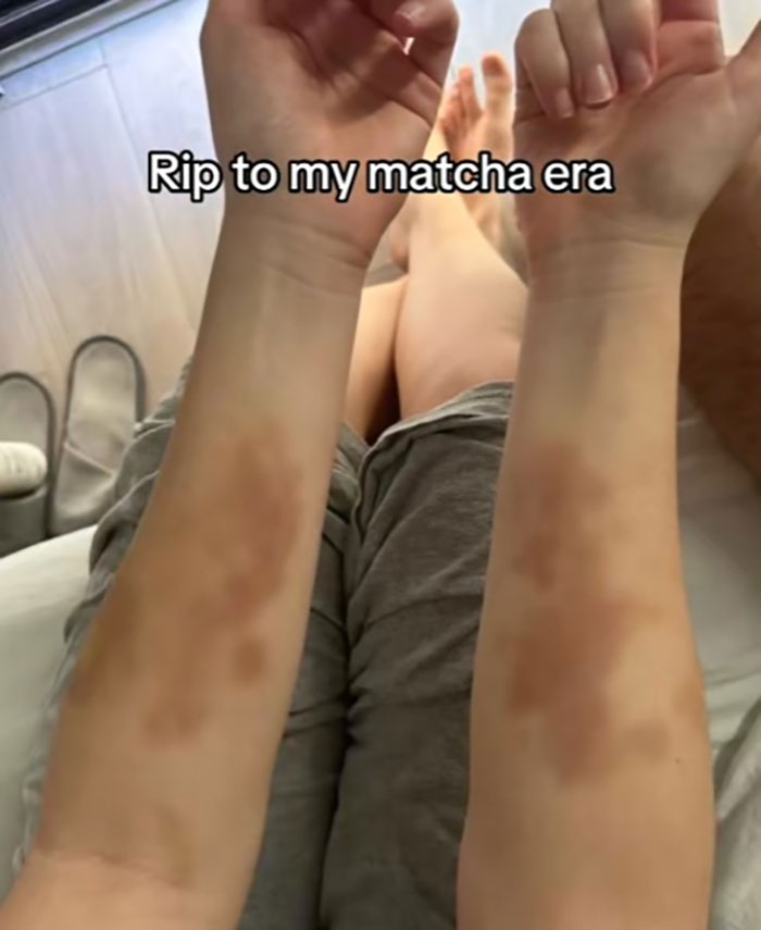 Woman Issues Public Warning After “Trendy” Drink Puts 28-Year-Old In Hospital