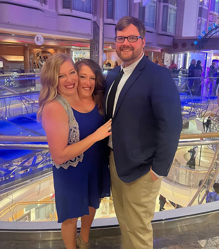 Legal Expert Explains The “Complexities” Of Conjoined Twins Abby And Brittany’s Newborn Situation