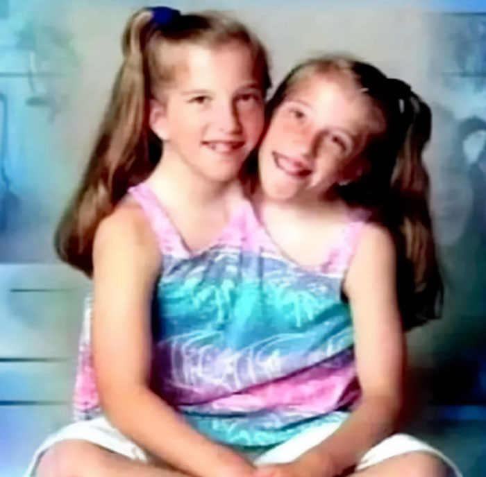 Legal Expert Explains The “Complexities” Of Conjoined Twins Abby And Brittany’s Newborn Situation