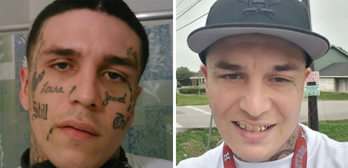 “Changed My Life!” 80 Photos Before And After Tattoo Removal