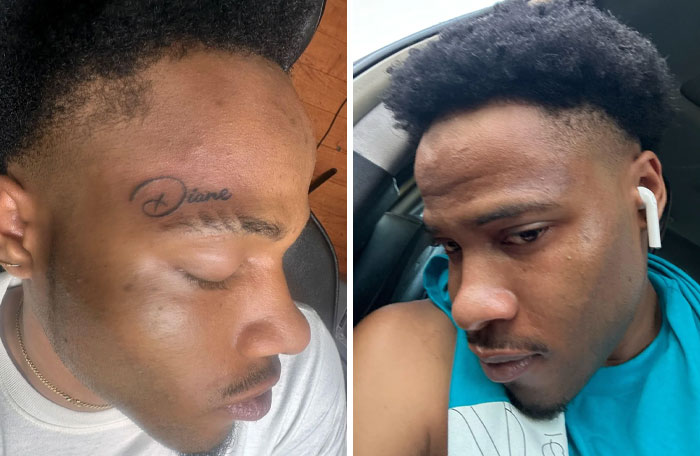 “Changed My Life!” 80 Photos Before And After Tattoo Removal