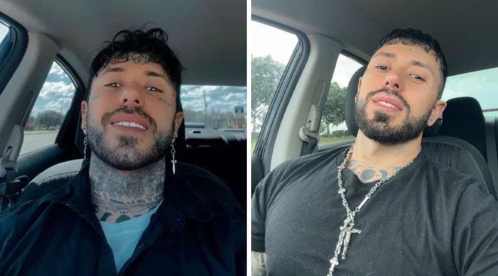 “Changed My Life!” 80 Photos Before And After Tattoo Removal