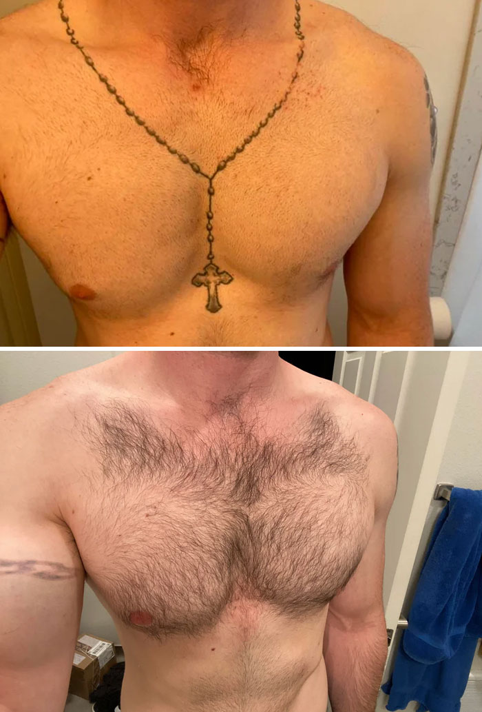 “Changed My Life!” 80 Photos Before And After Tattoo Removal