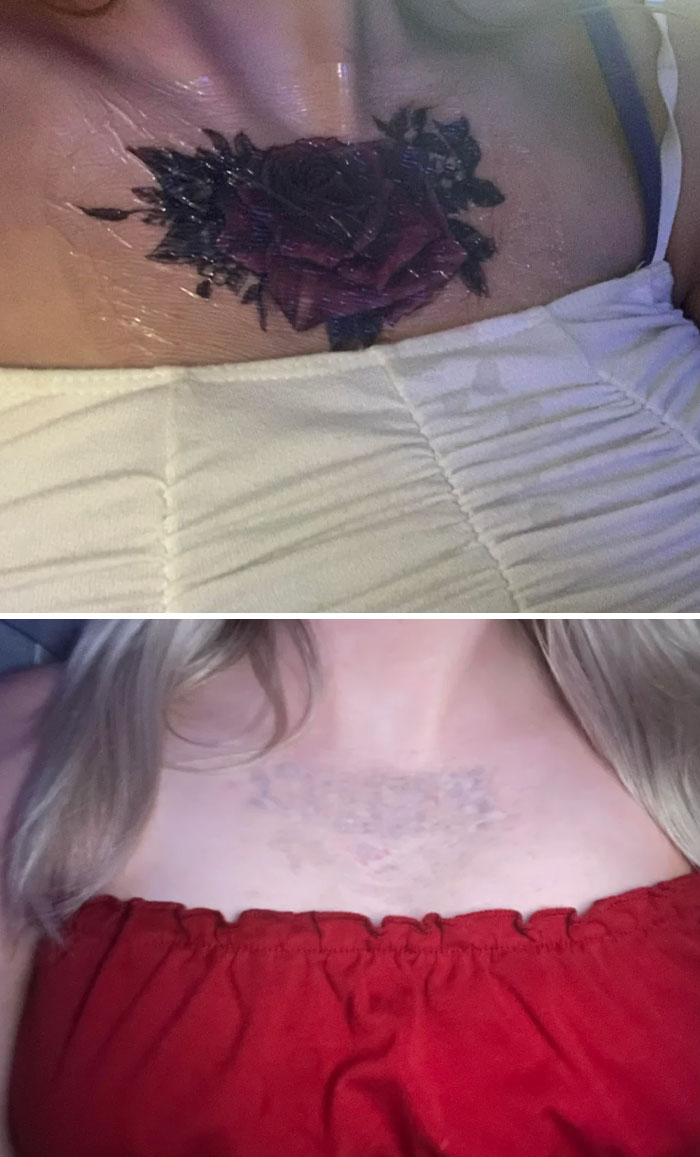 “Changed My Life!” 80 Photos Before And After Tattoo Removal