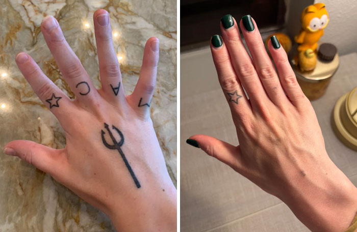 “Changed My Life!” 80 Photos Before And After Tattoo Removal