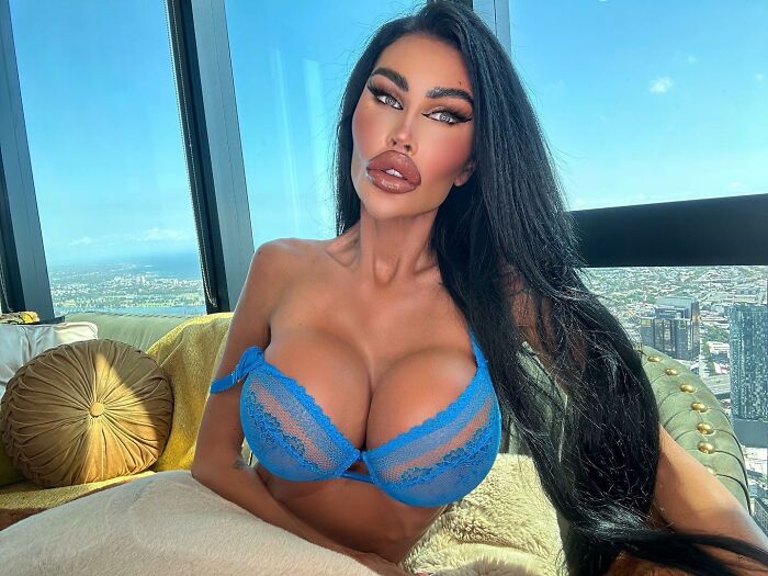 &#8216;Human Barbie&#8217; Who Spent $200k On Body Modifications Flaunts New Look Amid Plastic Surgery Concerns