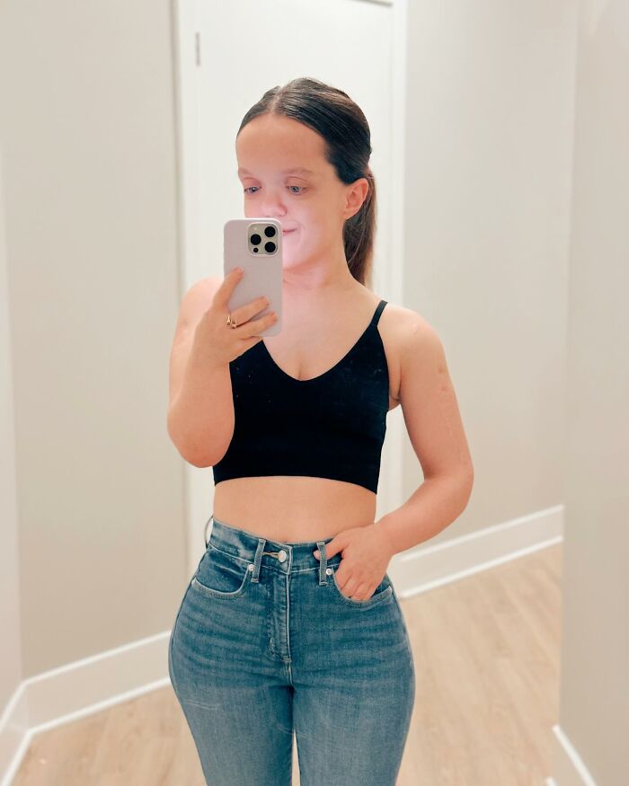 31YO Woman With Dwarfism Who Had Height Surgery As A Teen Stuns Fans With Transformation