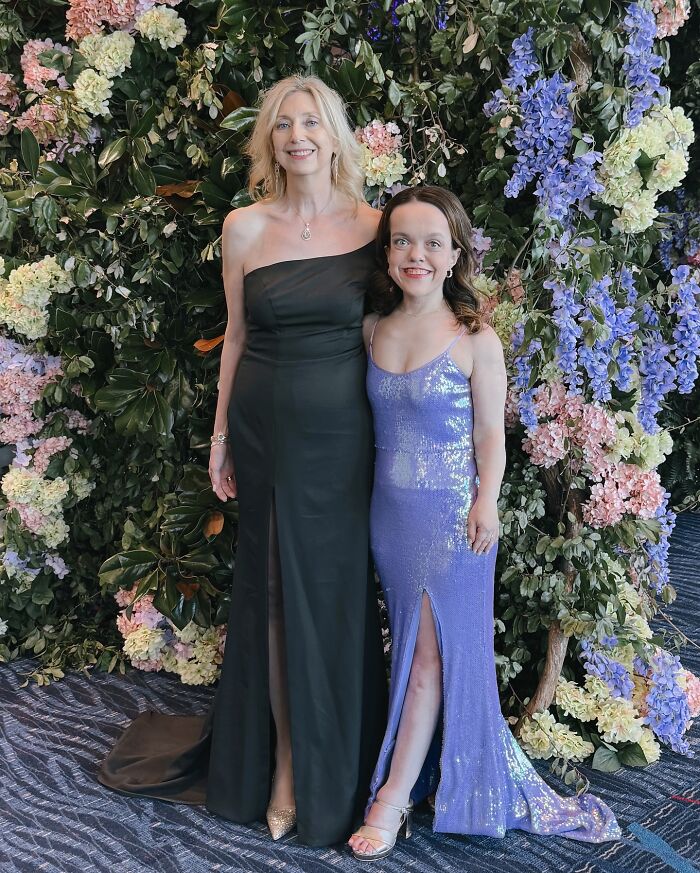 31YO Woman With Dwarfism Who Had Height Surgery As A Teen Stuns Fans With Transformation