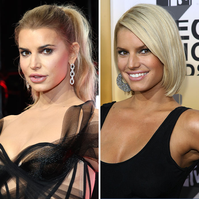 “Doesn’t Look Like Herself”: Fans Blast Jessica Simpson For Plastic Surgery At 2025 VMAs
